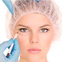 Blefaroplastia cirugia de parpados